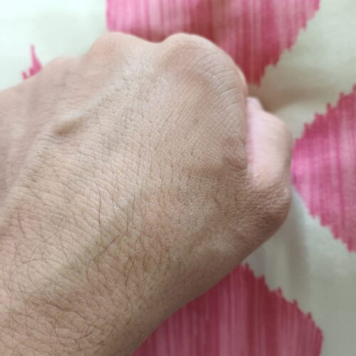 showing hand after application of cream